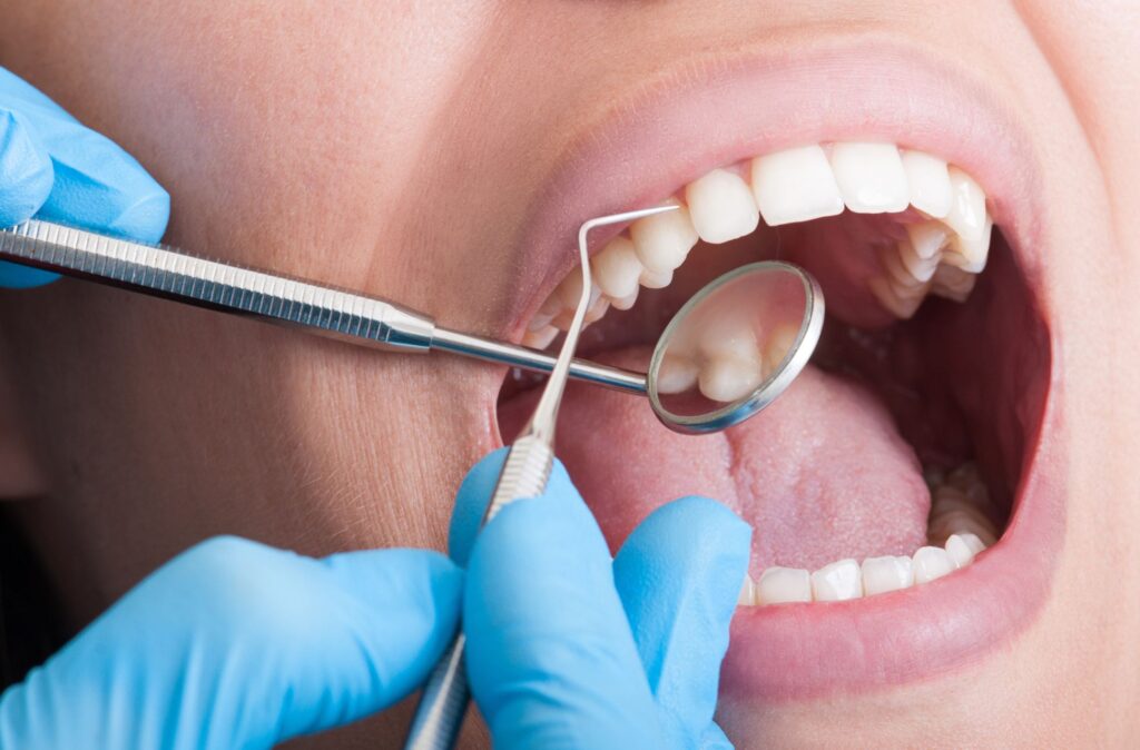 OTHER DENTAL