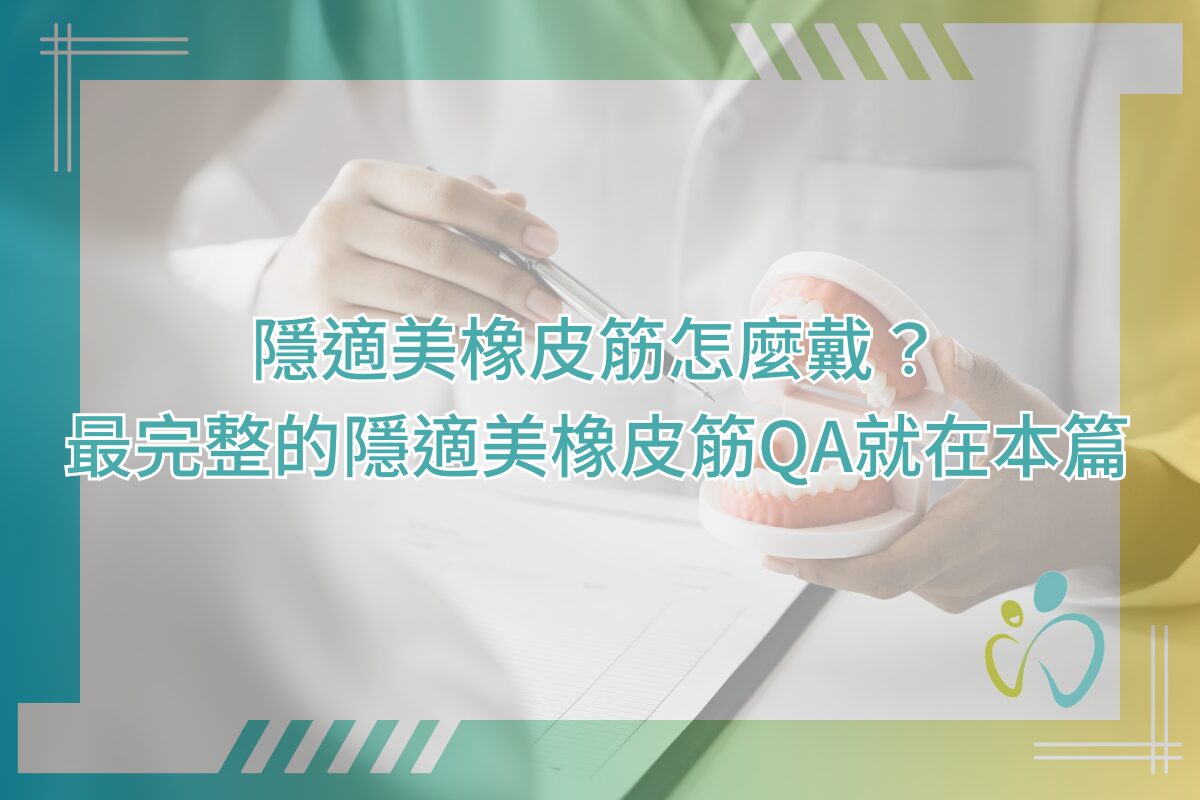 隱適美橡皮筋怎麼戴？最完整的隱適美橡皮筋QA就在本篇