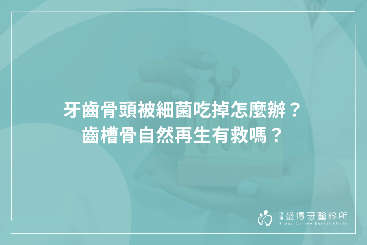 牙齒骨頭被細菌吃掉怎麼辦？齒槽骨自然再生有救嗎？