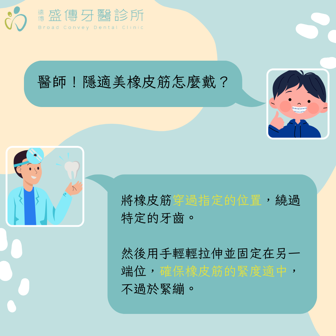 隱適美橡皮筋dcard網友問：怎麼戴？